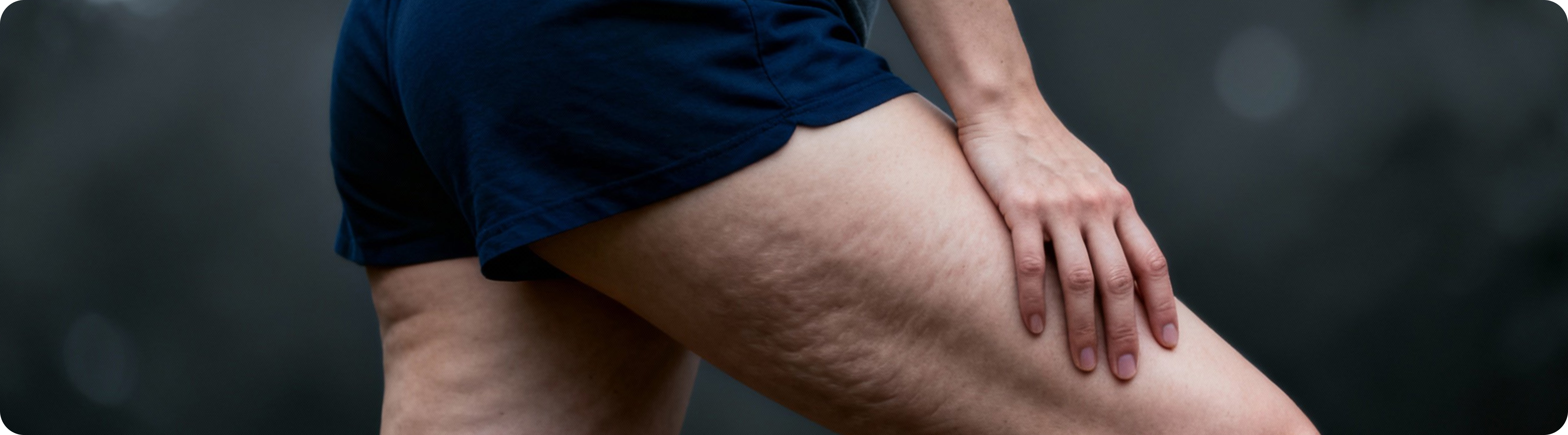 Superfit cellulite banner