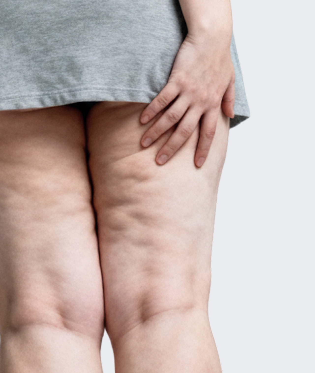 Feel Insecure In A Mini Skirt Or Swimsuit